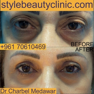 dr charbel medawar cosmetic surgery lebanon style beauty clinic