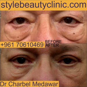 dr charbel medawar facial plastic surgeon lebanon style beauty clinic