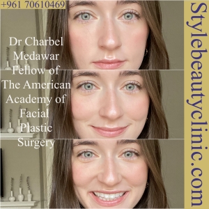 dr charbel medawar lebanon plastic surgery botox