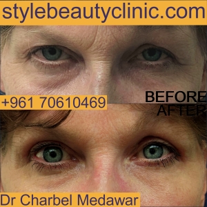 dr charbel medawar plastic surgery lebanon style beauty clinic