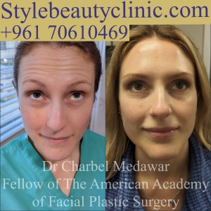 dr charbel medawar style beauty clinic botox beauty