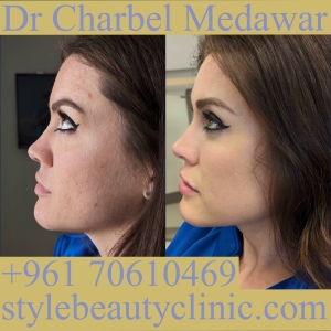 dr charbel medawar style beauty clinic skin care lebanon
