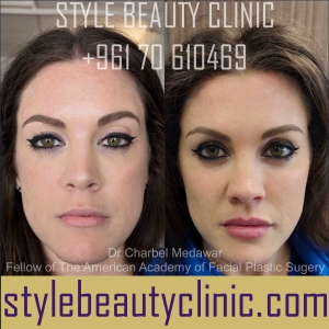 dr charbel medawar style beauty clinic
