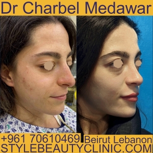 lebanon plastic surgery