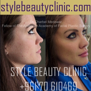 liquid facelift cheek lift jawline contouring lip fillers botox dr charbel medawar plastic surgery beirut lebanon style beauty clinic 33